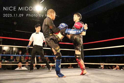 THE FIGHT SLIDE SHOW