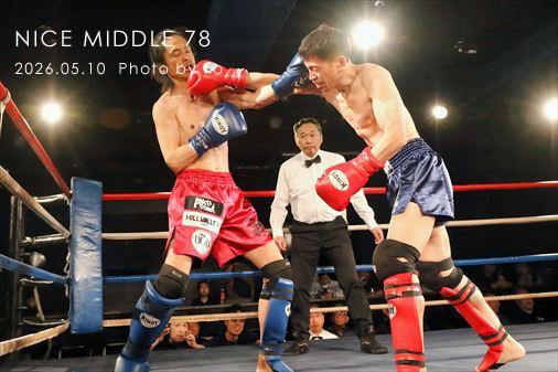 THE FIGHT SLIDE SHOW