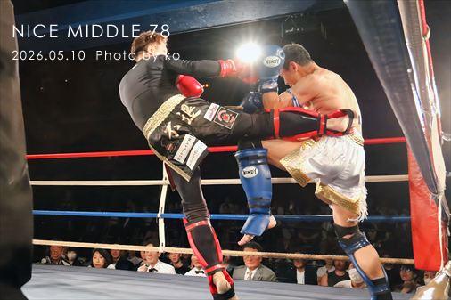 THE FIGHT SLIDE SHOW