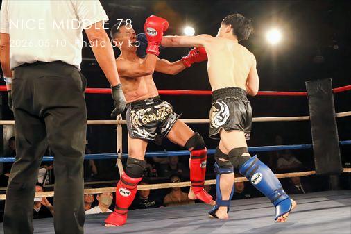 THE FIGHT SLIDE SHOW