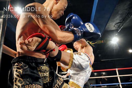THE FIGHT SLIDE SHOW